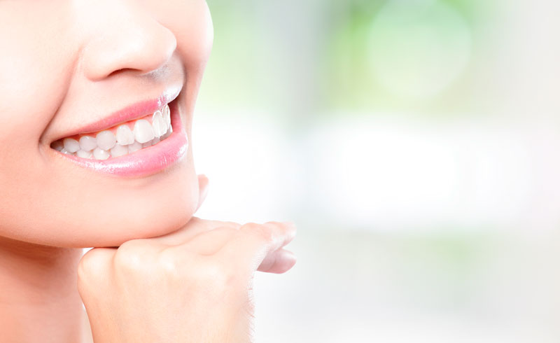 Dental Bridges