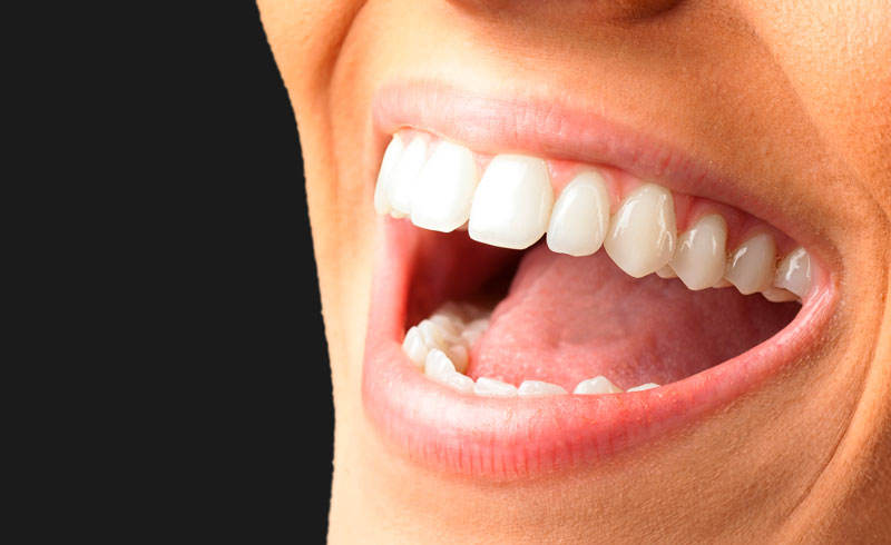Partial Dentures