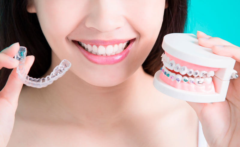 Invisalign Open House