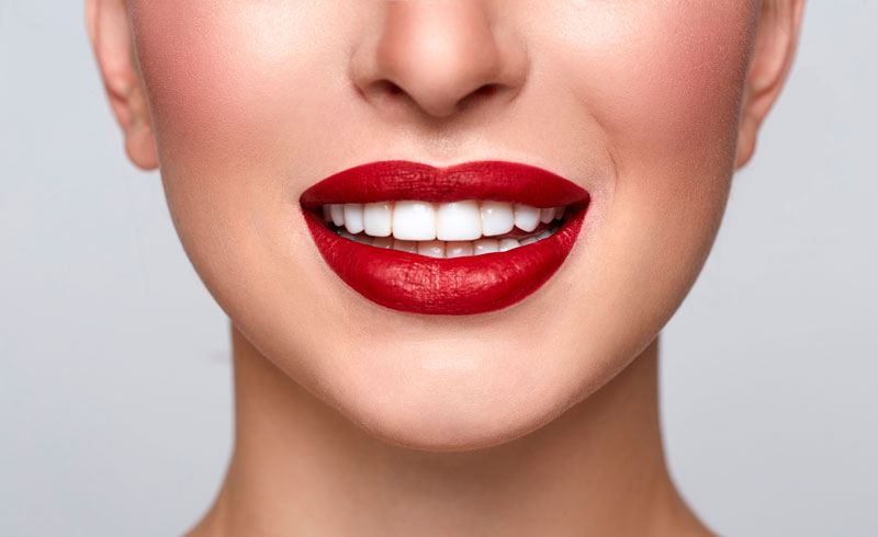 Longevity of Porcelain Veneers