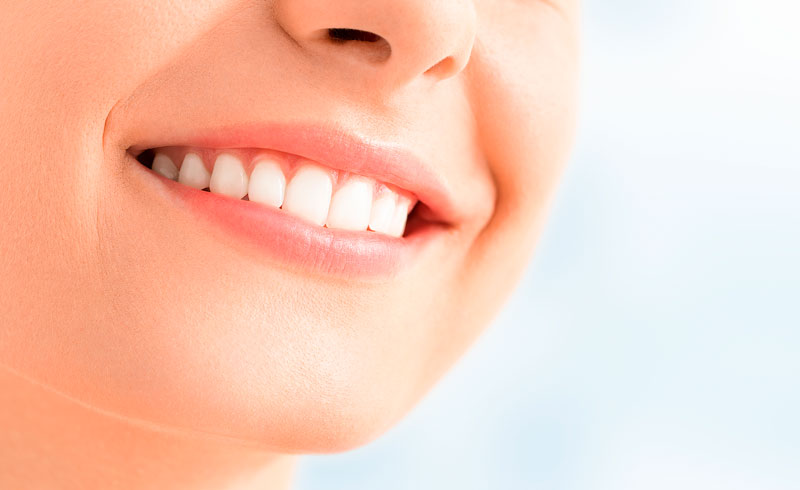 Tooth Bonding Conceals flaws