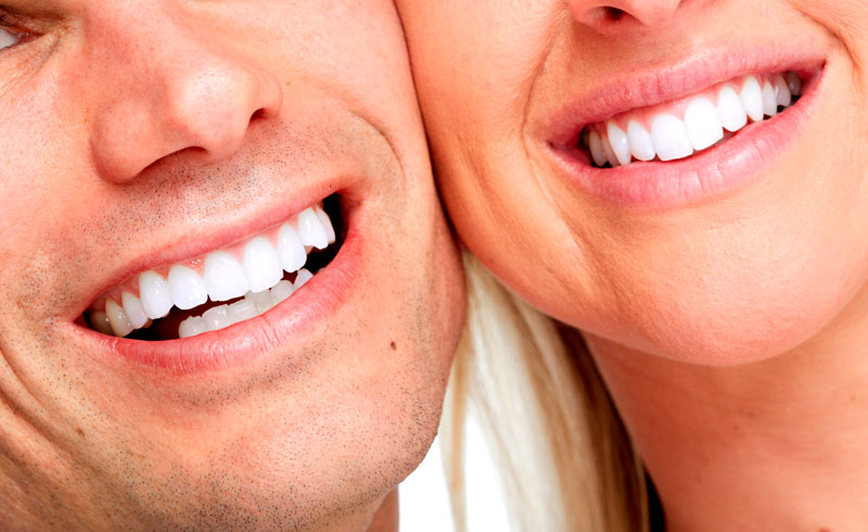 What is a Smile Makeover?
