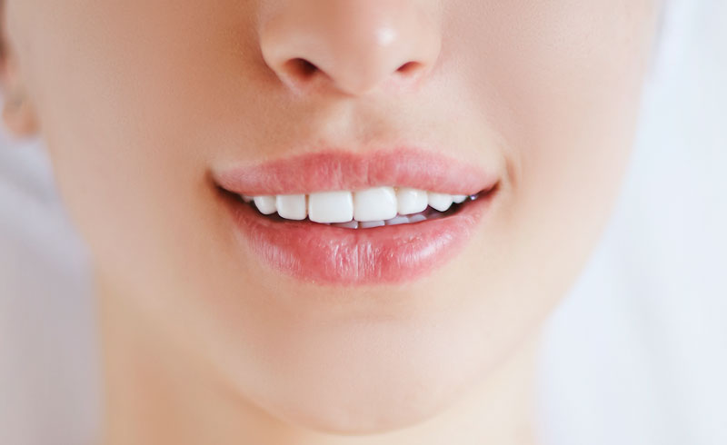 Do Veneers Stain?