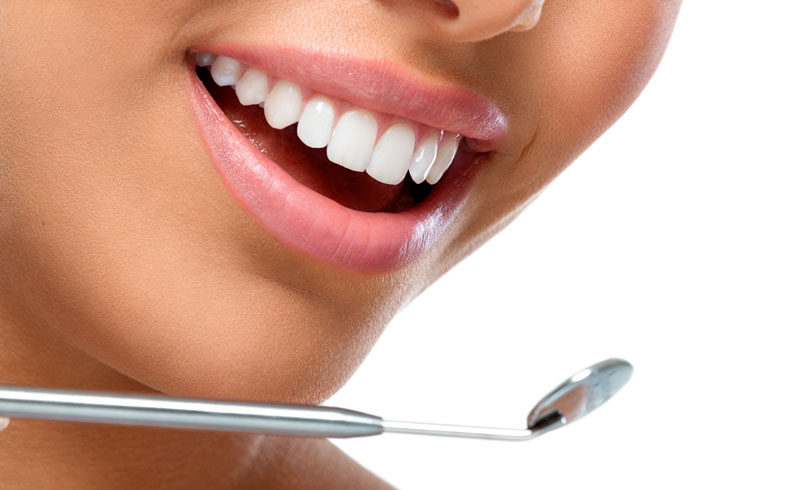 Best Solutions for Gapped Teeth