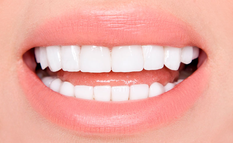 Five Things That Happen When Teeth are Missing