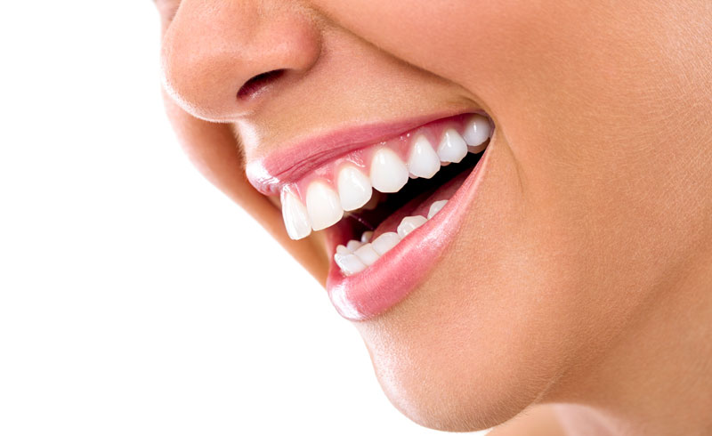 Will Whitening my Teeth Cause Sensitivity?