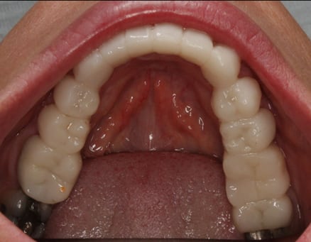 TMD-TMJ-Before-After-Photos-04-01